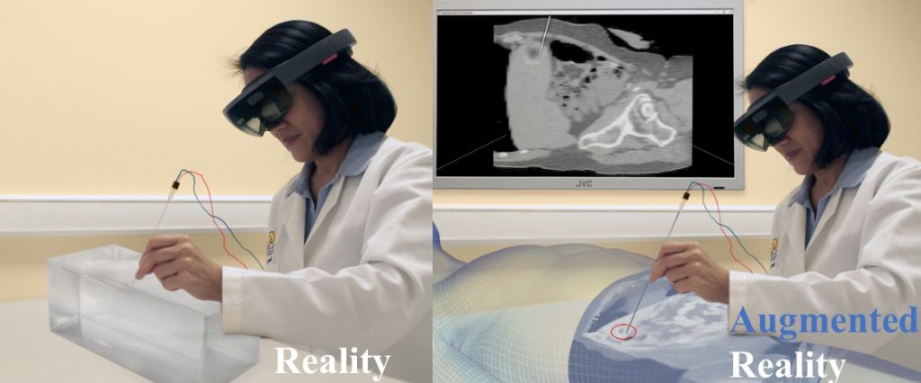 AR simulation for surgery